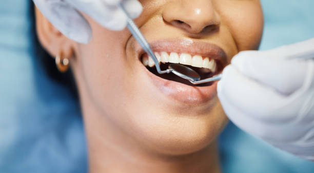 Best Emergency Dentist for Lost Fillings or Crowns in Bamberg, SC