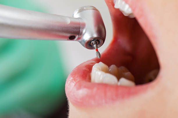 Best Emergency Dentist for Knocked-Out Tooth in Bamberg, SC
